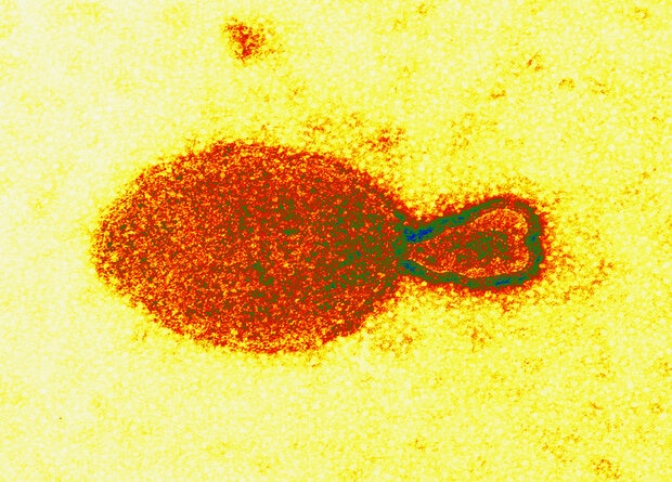 Один из представителей генипавирусов — Hendra henipavirus